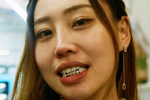 Phong cách làm đẹp răng thời thượng