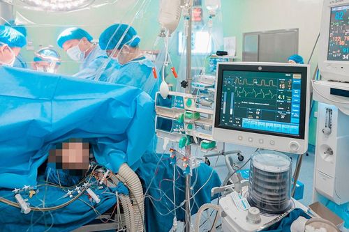 Phẫu thuật thành công cho bé gái 9 tuổi suy thận mạn