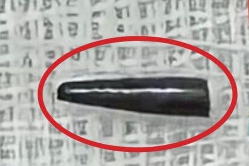 Bé trai bị ruột bút chì xuyên thủng nhãn cầu