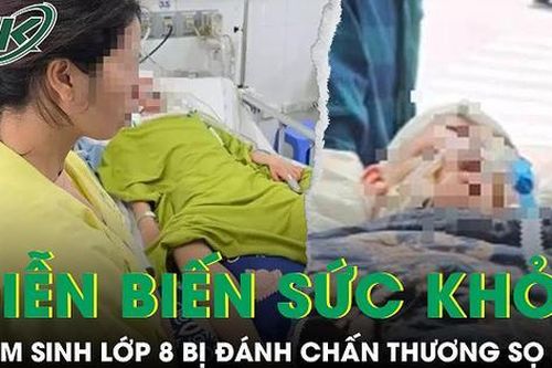 Diễn biến mới về tình trạng sức khỏe của nam sinh lớp 8 bị đánh chấn thương sọ não