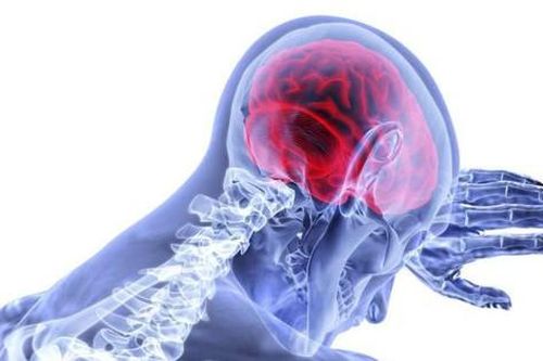 Tiềm năng của trí tuệ nhân tạo trong việc xác định tổn thương não sau đột quỵ