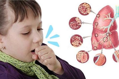 Cẩn trọng với bệnh ho gà ở trẻ