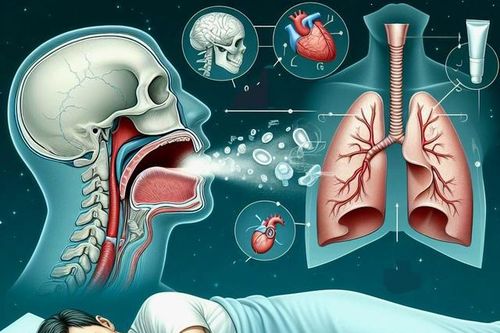 Giải đáp 10 câu hỏi thường gặp về ngủ ngáy