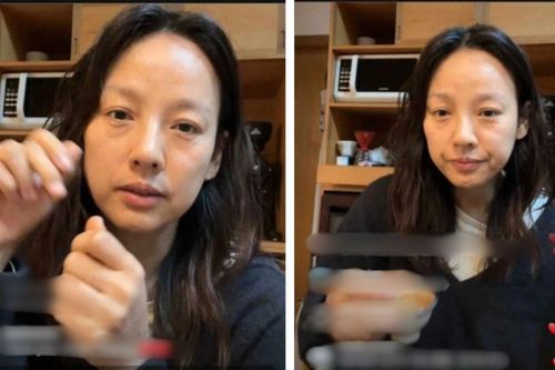 Sự thật đằng sau gương mặt lão hóa của Nữ hoàng giải trí Lee Hyori