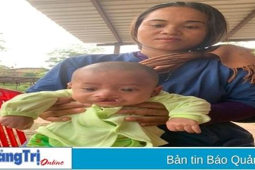 Để nụ cười của con được vẹn nguyên