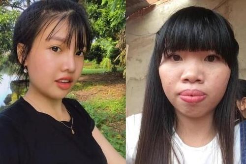 Từng đập mặt đi xây lại, 'Thị Nở tái sinh' hình ảnh hiện tại gây ngỡ ngàng