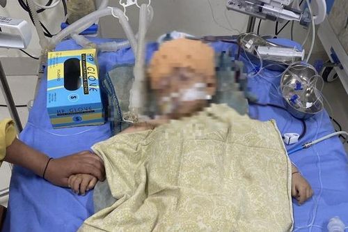 Sơn La: Công an vào cuộc xác minh, làm rõ vụ cháu bé 1 tuổi bị chấn thương não ở trường mầm non