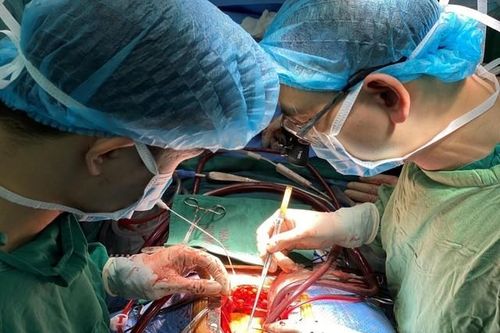 Phẫu thuật bắc cầu chủ vành – phương pháp điều trị tối ưu cho bệnh nhân mắc bệnh lý mạch vành nặng