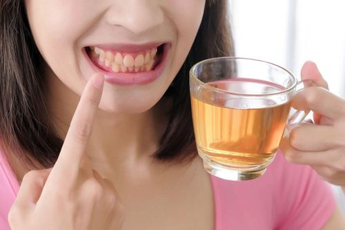 Nguyên nhân khiến răng luôn ố vàng
