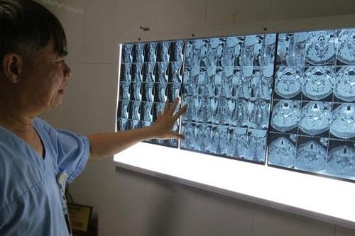 Bệnh nhân thoát tàn phế nhờ mổ u tủy sống