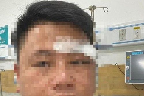 Đà Nẵng: Một luật sư bị nhóm người lạ mặt hành hung gây thương tích