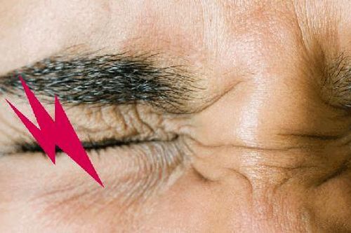 Chớp mắt bị đau là do đâu? Cẩn thận bị mất thị lực vĩnh viễn!