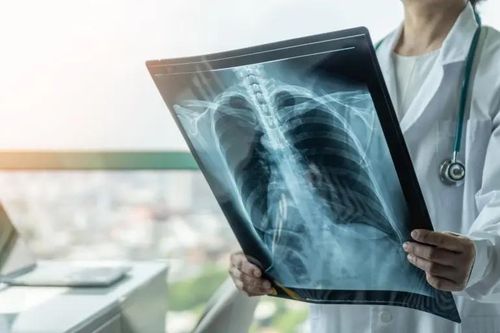 Yếu tố tăng nguy cơ mắc ung thư ở người trẻ