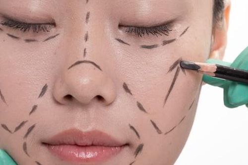 Ai không thích hợp để phẫu thuật thẩm mỹ?