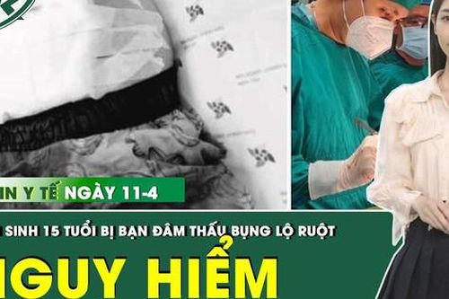 Những thông tin y tế nổi bật ngày 11/4