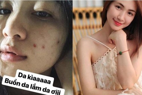 Hòa Minzy tiết lộ loại rau giúp làn da cô trắng mịn, mùa hè người Việt nên ăn để thải độc và kéo dài tuổi thọ