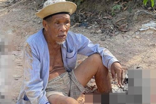 Bình Định: Truy tìm xe ben cán nát chân cụ ông 85 tuổi rồi bỏ chạy