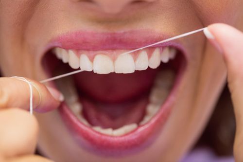 Sự thật ít ai biết về chỉ nha khoa
