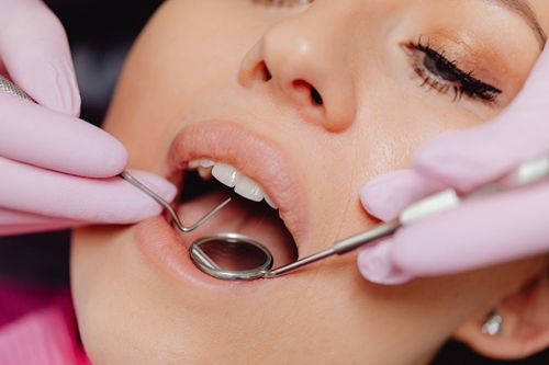 Những sự thật ít người biết về sâu răng