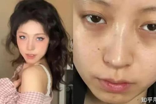 Căng thẳng nhân đôi, nhan sắc giảm 10, cô gái trẻ đòi công ty bồi thường 30 triệu để lên đời nhan sắc