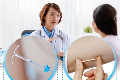 Lấy vòng tránh thai 'đi lạc' trong ổ bụng cho hai phụ nữ