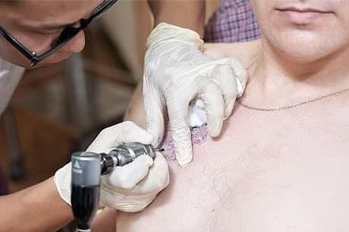 Sau 19 năm chung sống, vợ bắt quả tang bằng chứng ngoại tình của chồng chỉ nhờ chi tiết này trên cơ thể