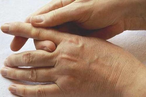 Bong gân ngón tay: Dấu hiệu nhận biết và cách điều trị