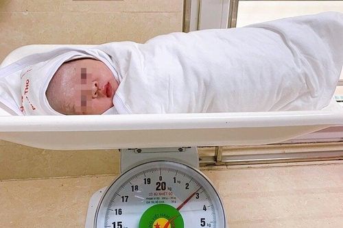 Em bé chào đời với dây rốn quấn cổ 5 vòng hiếm gặp