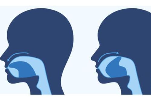 Bài tập cho người bị chứng ngừng thở khi ngủ