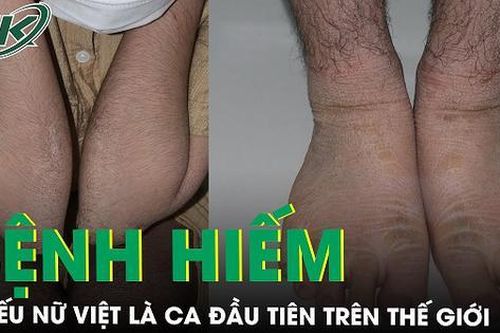 Thiếu nữ bất ngờ phát hiện mắc bệnh hiếm được báo cáo là ca đầu tiên trên thế giới