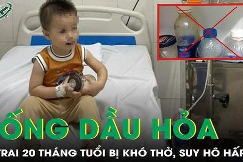 Uống dầu hỏa, bé trai 20 tháng tuổi bị khó thở, suy hô hấp