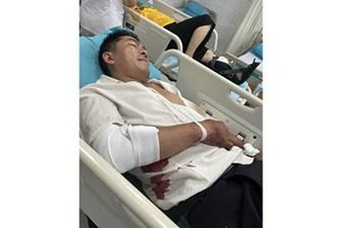 Lâm Đồng: Truy bắt các đối tượng sử dụng hung khí tấn công người dân
