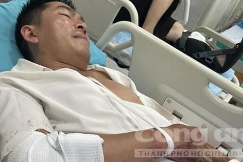 Bắt khẩn cấp đối tượng đột nhập trộm tài sản, chém thẩm phán thương tích