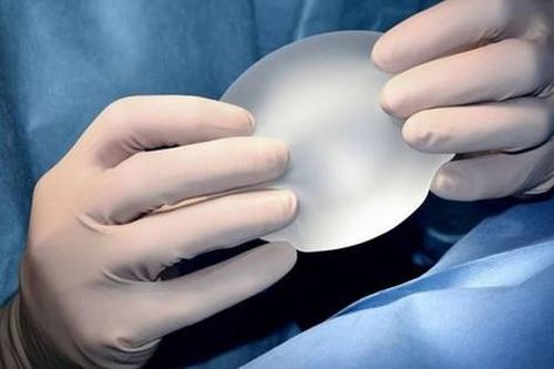 Đi khám tổng quát bất ngờ phát hiện vỡ túi nâng ngực