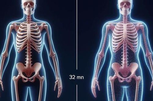 Người bị loãng xương có nên tập thể dục?