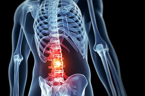 Bộ Y tế Nga đăng ký loại thuốc đầu tiên trên thế giới điều trị bệnh Bekhterev