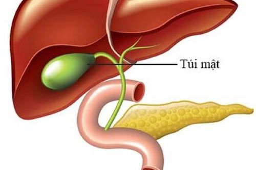 Polyp túi mật là gì? Khi nào cần điều trị?