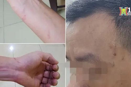 Thực nghiệm hiện trường phóng viên bị hành hung
