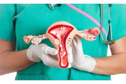 Phụ nữ nên biết 7 nguyên nhân gây ung thư buồng trứng