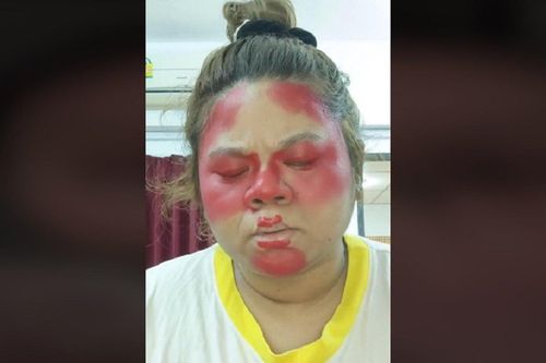 Hậu quả của việc 'đu trend' trang điểm trên mạng