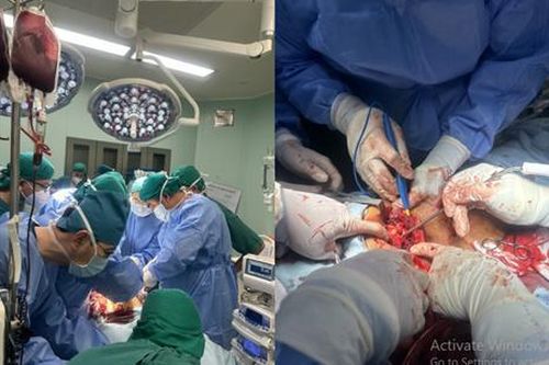 Cấp cứu kịp thời bệnh nhân bị đâm thấu ngực, gan
