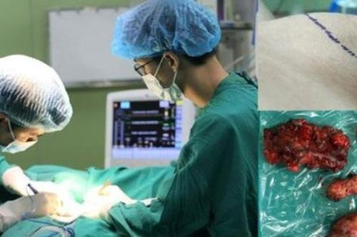 Thanh niên 24 tuổi phát hiện ung thư tuyến giáp, phải cắt toàn bộ tuyến giáp vì mắc 1 sai lầm mà nhiều người Việt mắc phải