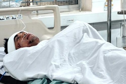Nạn nhân sống sót bàng hoàng sau vụ nổ lò hơi: 'Ngày lễ em đi làm vì có thêm tiền, cố gắng để lo cho gia đình...'