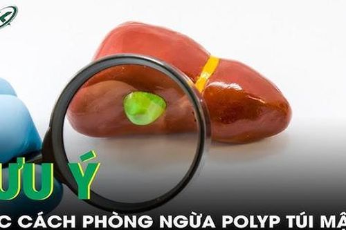 Lưu ý các cách phòng ngừa polyp túi mật