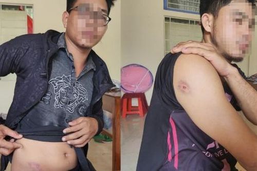 Ba người lái máy gặt thuê bị hành hung ở Quảng Trị