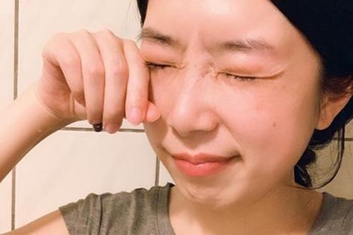 '2 ngứa, 2 đỏ, 2 đau' cho thấy gan kiệt sức vì bệnh tật, không thể tự tái tạo