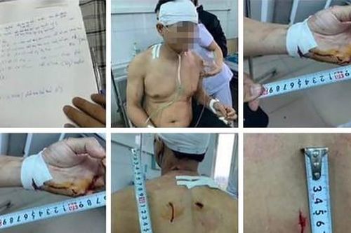 Bắt đối tượng đâm trọng thương Phó Chánh án TAND huyện tại phòng làm việc