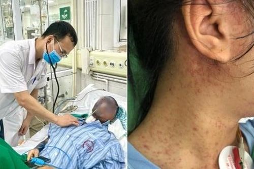Nữ bệnh nhân 17 tuổi suýt chết do biến chứng thủy đậu