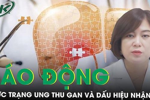 Thực trạng đáng báo động của ung thư gan hiện nay và các dấu hiệu nhận biết