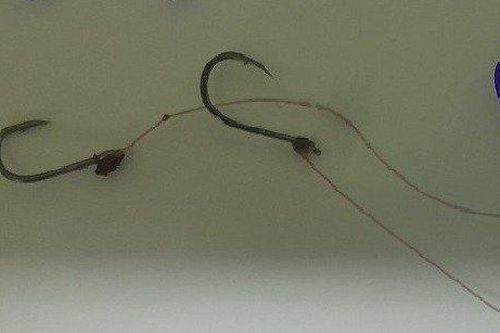 Nội soi gắp lưỡi câu cùng dây cước mắc kẹt trong thực quản của bé trai